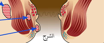 /خراج حول منطقة  الشرج